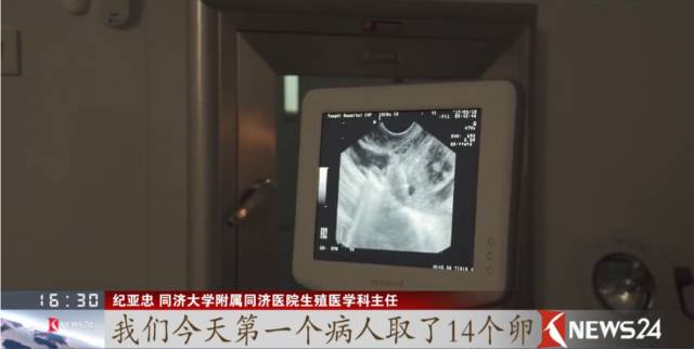 取卵针长什么样取卵的真相_https://www.jmylbn.com_新闻资讯_第9张