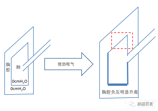 呼吸机f指什么呼吸机名词解释（三）_https://www.jmylbn.com_新闻资讯_第6张