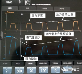 呼吸机f指什么呼吸机名词解释（三）_https://www.jmylbn.com_新闻资讯_第29张