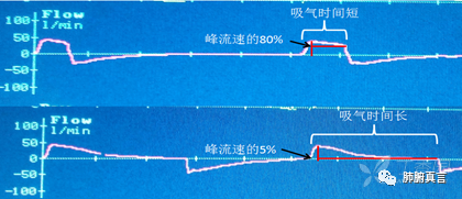 呼吸机f指什么呼吸机名词解释（三）_https://www.jmylbn.com_新闻资讯_第28张