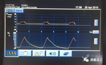 呼吸机f指什么呼吸机名词解释（三）_https://www.jmylbn.com_新闻资讯_第27张