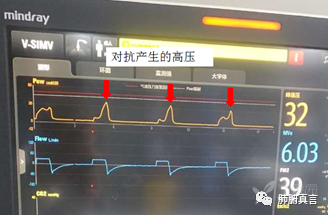 呼吸机f指什么呼吸机名词解释（三）_https://www.jmylbn.com_新闻资讯_第25张