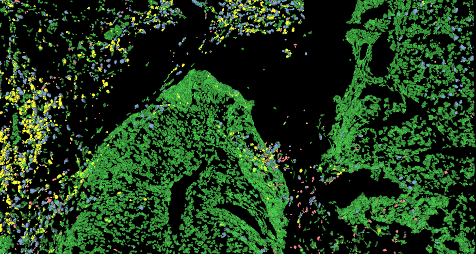 Aivia 14發(fā)布會(huì)：開啟3D空間生物學(xué)分析新紀(jì)元