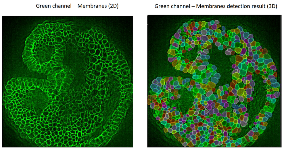 Aivia 14發(fā)布會(huì)：開啟3D空間生物學(xué)分析新紀(jì)元