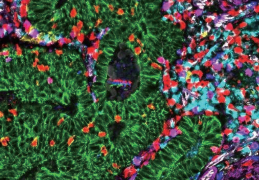 徠卡精準(zhǔn)空間生物學(xué)解決方案 第三彈
