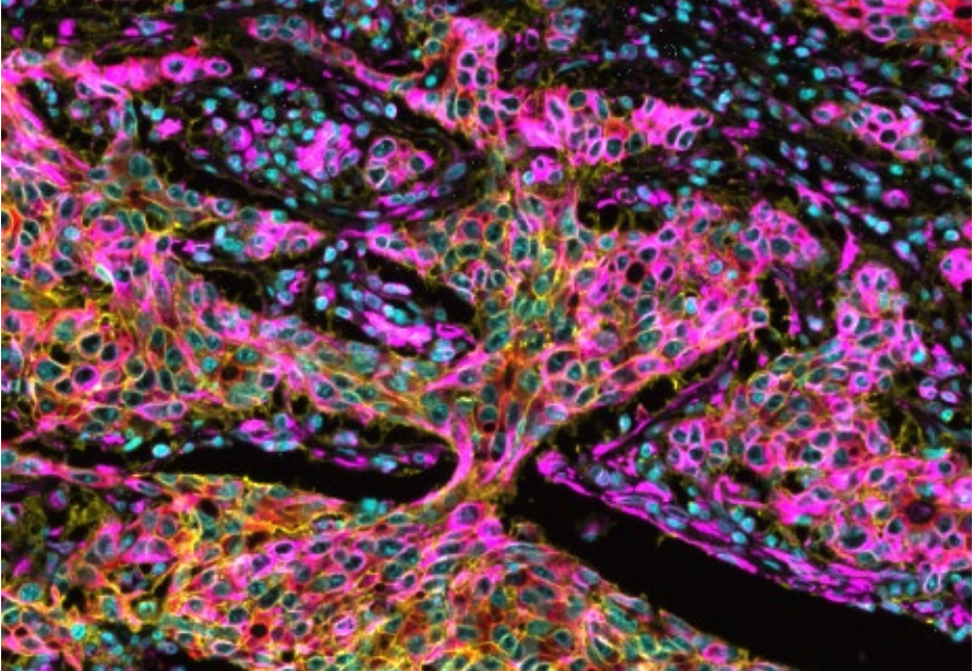 徠卡精準(zhǔn)空間生物學(xué)解決方案 第三彈