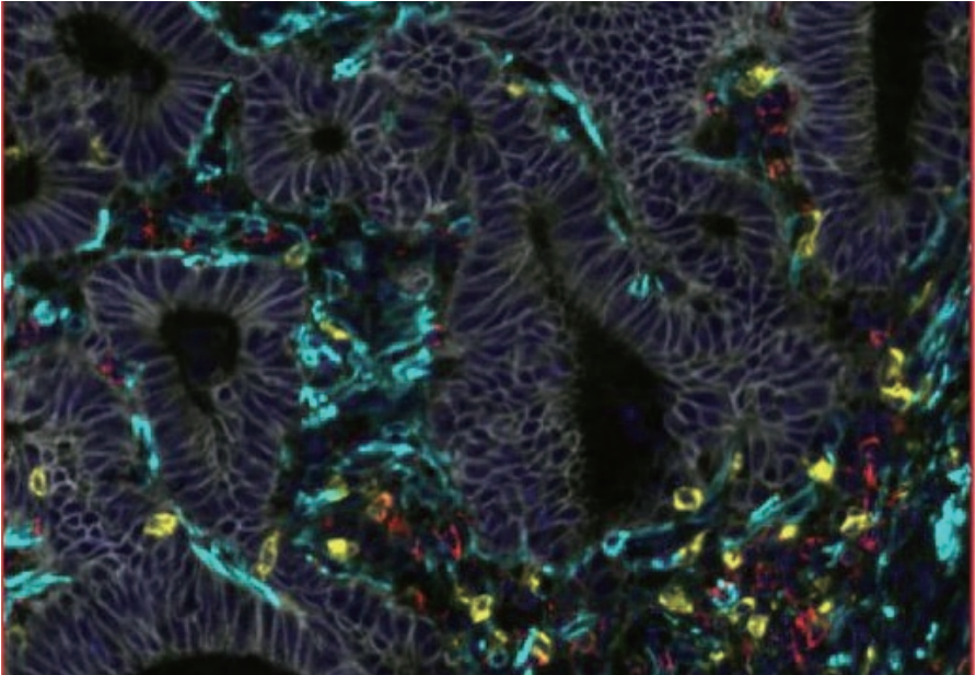 徠卡精準(zhǔn)空間生物學(xué)解決方案 第三彈