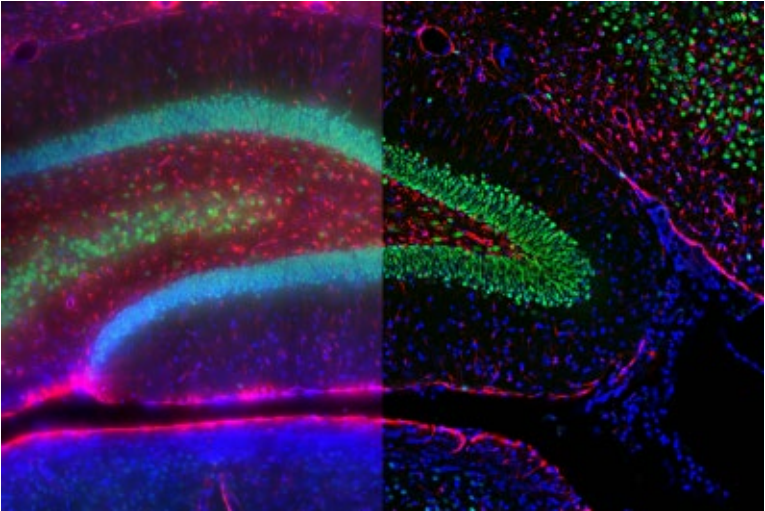 徠卡精準(zhǔn)空間生物學(xué)解決方案 第三彈