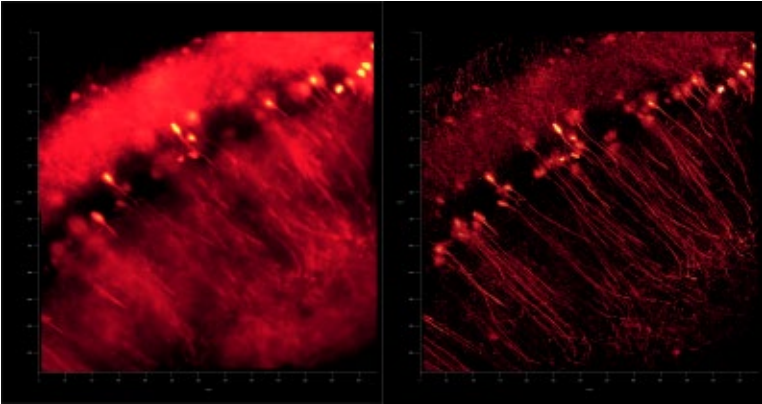 徠卡精準(zhǔn)空間生物學(xué)解決方案 第三彈