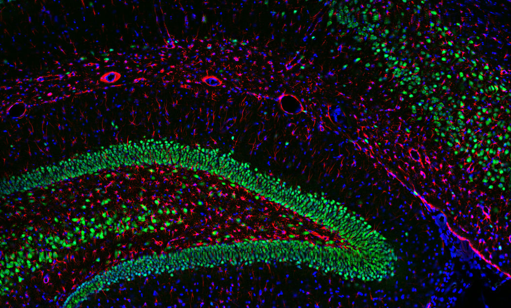 多色显微成像多通道的重要性