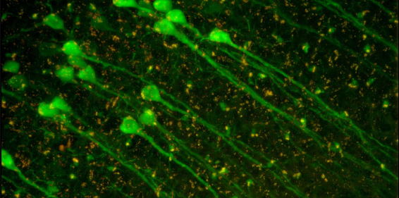 阿爾茨海默癥(AD)機(jī)制研究中的組織及細(xì)胞光學(xué)成像（上篇）