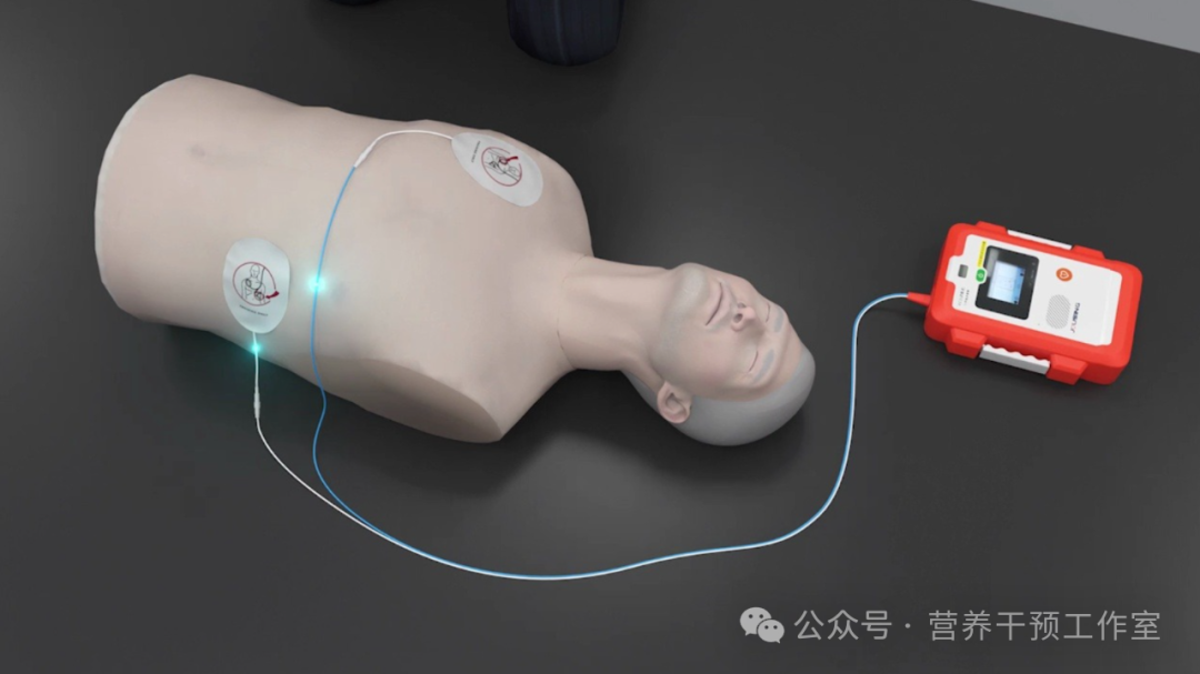 除颤仪性能有哪些经常说的救命神器除颤仪如何使用？除颤仪的15条硬货知识_https://www.jmylbn.com_新闻资讯_第4张