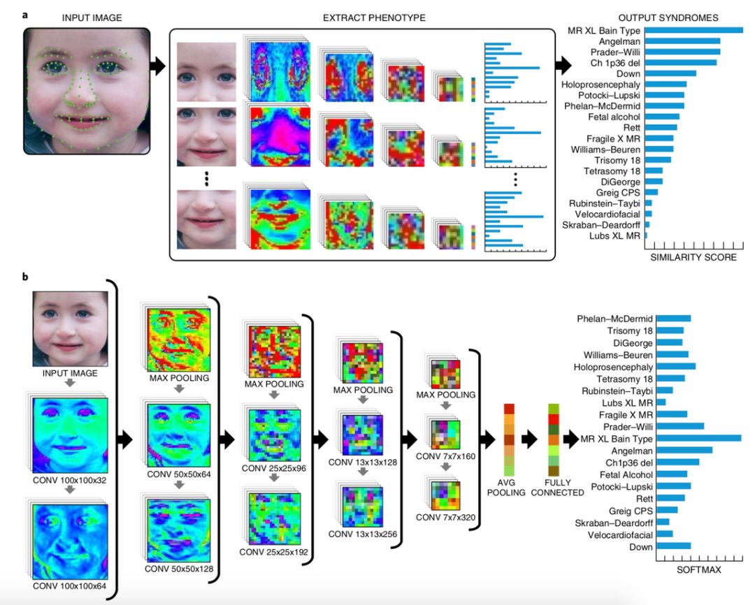 登上Nature&Science，AI「看面相」識別遺傳病準確率達91%