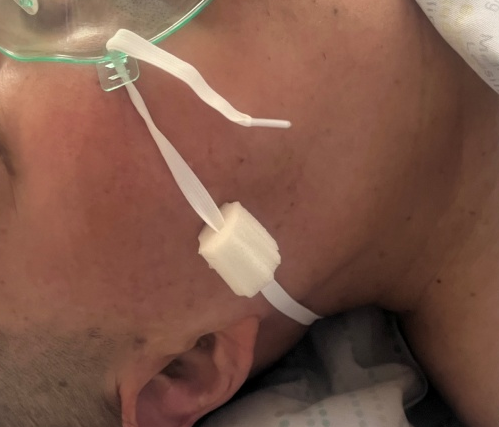 吸氧管怎么戴图解吸氧面罩戴久了脸疼怎么办？这位建医美小护有方法！超实用_https://www.jmylbn.com_新闻资讯_第14张