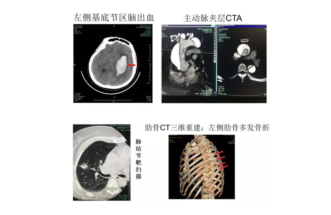 x光和dr有什么区别X、DR、CT、MRI……都是拍片，区别其实很简单_https://www.jmylbn.com_新闻资讯_第6张