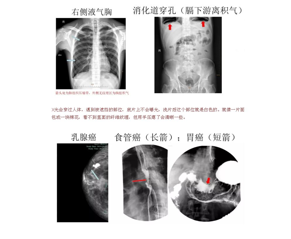x光和dr有什么区别X、DR、CT、MRI……都是拍片，区别其实很简单_https://www.jmylbn.com_新闻资讯_第4张