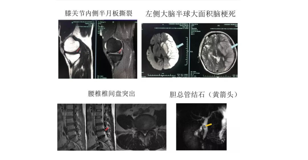 x光和dr有什么区别X、DR、CT、MRI……都是拍片，区别其实很简单_https://www.jmylbn.com_新闻资讯_第8张