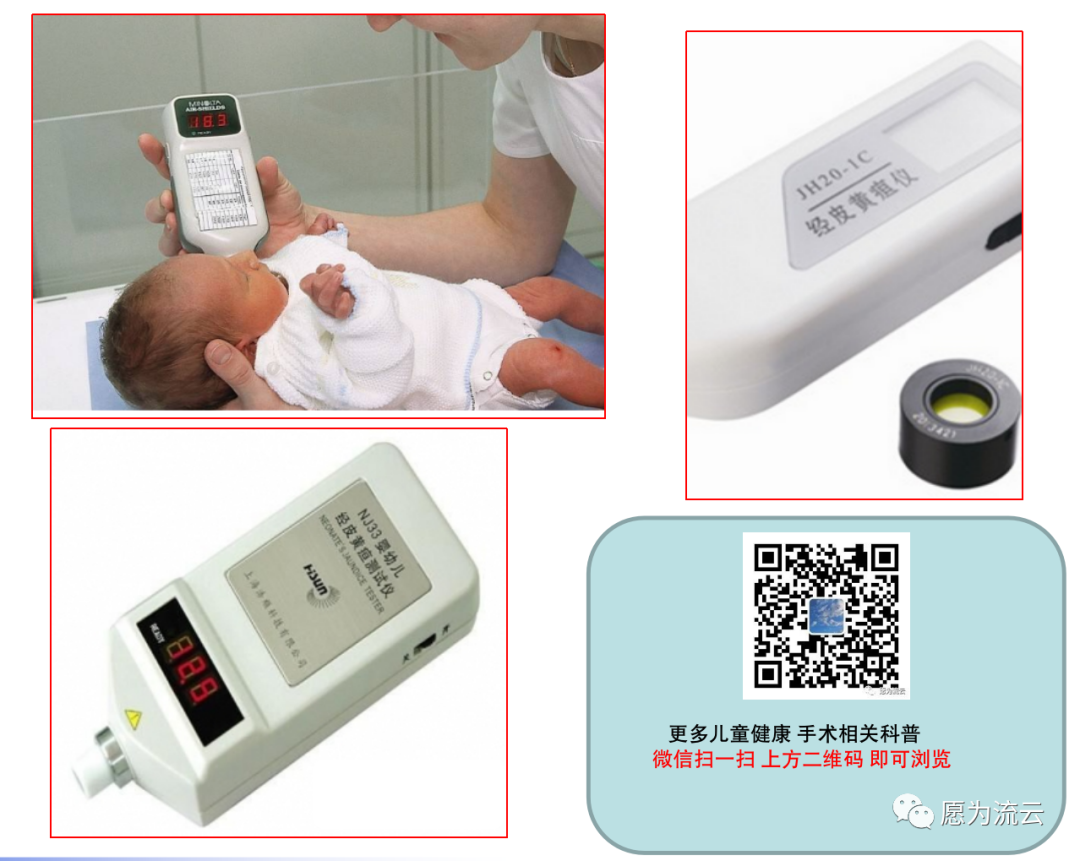 经皮胆红素怎么计算经皮胆红素正常值？和血里胆红素一样？-黄疸、经皮测胆仪？_https://www.jmylbn.com_新闻资讯_第5张