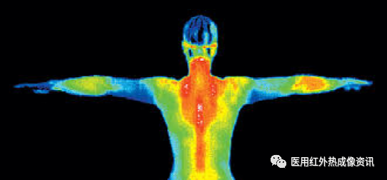 医用红外热像仪怎么开机【健康科普】热像仪医疗应用_https://www.jmylbn.com_新闻资讯_第7张