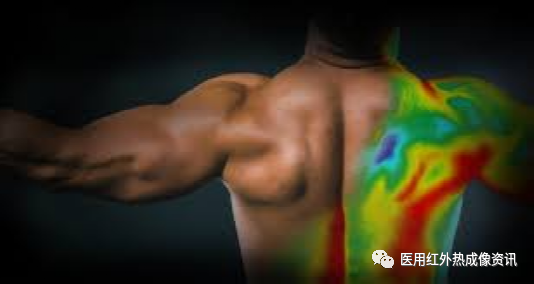 医用红外热像仪怎么开机【健康科普】热像仪医疗应用_https://www.jmylbn.com_新闻资讯_第5张