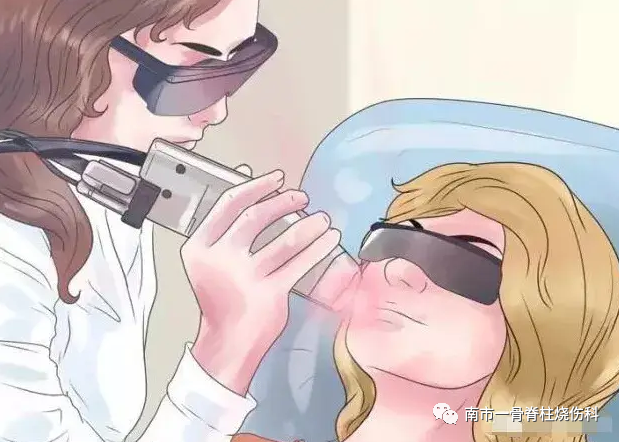 点阵激光后冷敷怎么敷【再添利器】烧伤与创面修复科引进“皮肤的橡皮擦”——二氧化碳点阵激光仪_https://www.jmylbn.com_新闻资讯_第6张