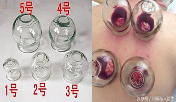 口腔器械消毒规范_口腔科器械消毒流程_消毒器械类