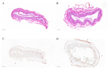 双极电凝镊为什么不粘Frontiers in Surgery：骨蜡涂层可有效提高双极电凝的止血性能！_https://www.jmylbn.com_新闻资讯_第5张