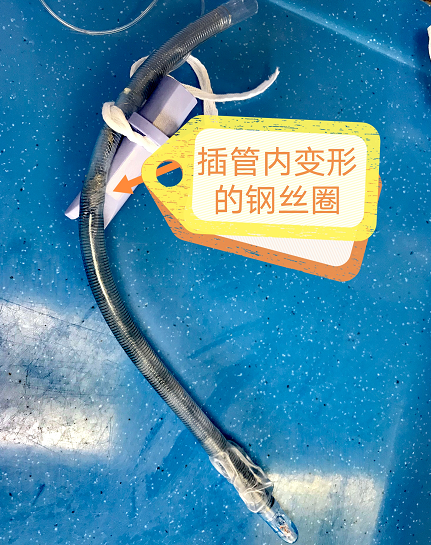 加强器官插管怎么用紧急！吸痰管放不进气道！_https://www.jmylbn.com_新闻资讯_第12张