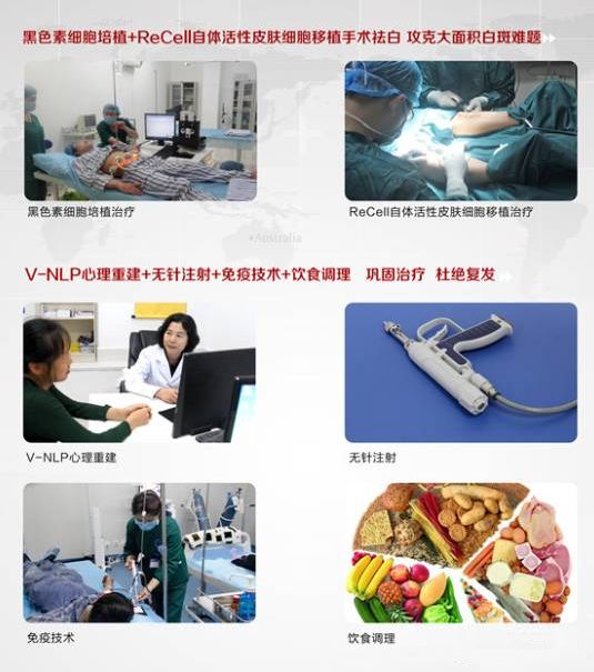 這樣治療白癜風，療效可提升80% 健康 第6張