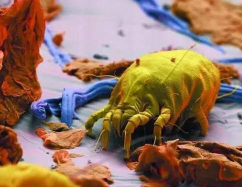 头皮痒！头螨正在啃食你的头皮!