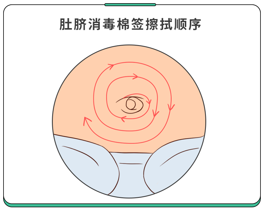 ①初期症状:根部发红,脐带残端不愈合或有少量渗血,有渗液或少许淡