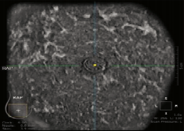 什么是超声容积探头【解读】自动乳腺容积超声技术专家共识 (2022 版)_https://www.jmylbn.com_新闻资讯_第5张