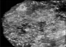 什么是超声容积探头【解读】自动乳腺容积超声技术专家共识 (2022 版)_https://www.jmylbn.com_新闻资讯_第18张