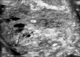 什么是超声容积探头【解读】自动乳腺容积超声技术专家共识 (2022 版)_https://www.jmylbn.com_新闻资讯_第17张