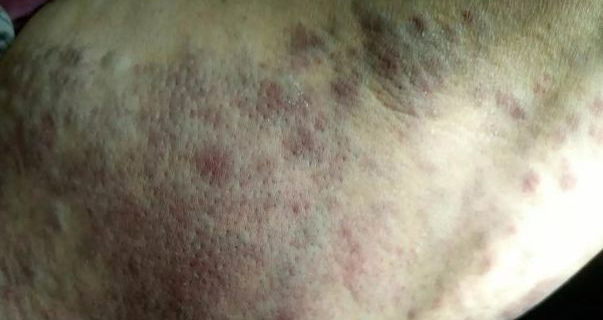 BE药片治什么作用只需拍打一处，竟然可以调理这么多慢性病，省了太多苦药片_https://www.jmylbn.com_新闻资讯_第1张