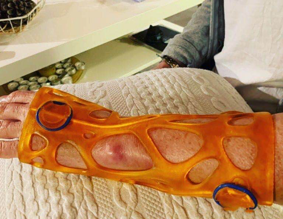 3D打印