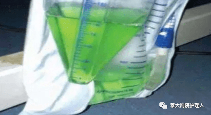 弯头导尿管怎么用小小尿管作用大，自行拔出危害大！_https://www.jmylbn.com_新闻资讯_第33张