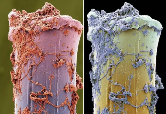 牙齿蛀虫显微镜图片
