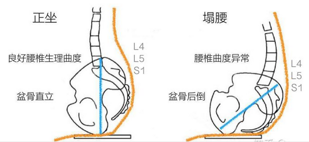 坐多久才算「久坐」？超過這個時長你的腰不堪重負 健康 第4張