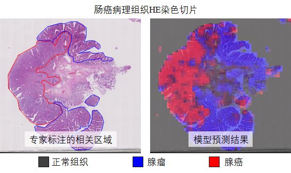 騰訊AI八篇論文入選頂級醫學影像會議MICCAI ，涉及病理癌症影像分類等