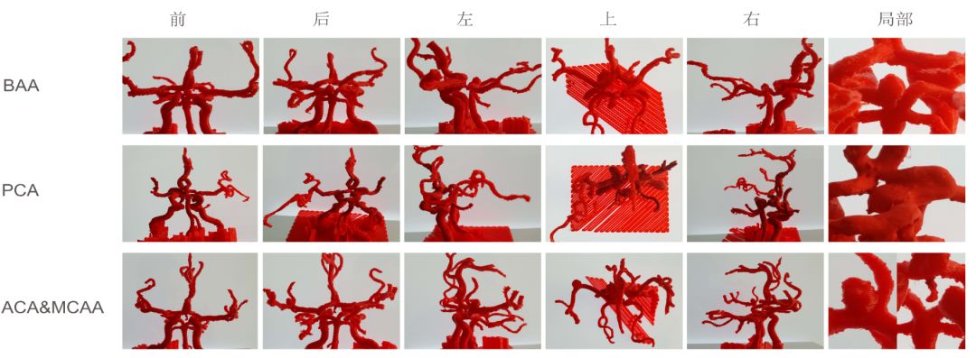 3D列印微創治療腦出血 科技 第10張