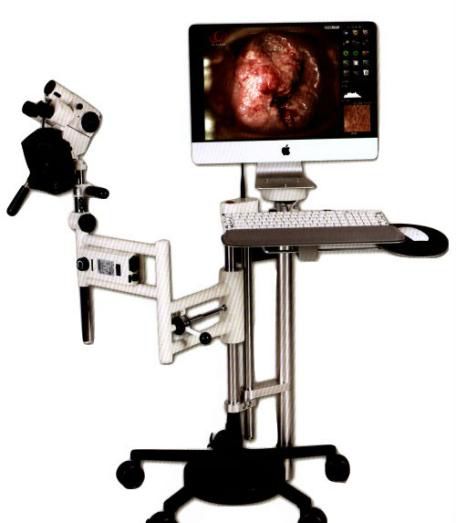 妇科检查用什么仪器玉溪市人民医院最新引进全球先进妇科阴道镜检查仪器_https://www.jmylbn.com_新闻资讯_第2张