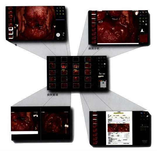 妇科检查用什么仪器玉溪市人民医院最新引进全球先进妇科阴道镜检查仪器_https://www.jmylbn.com_新闻资讯_第5张