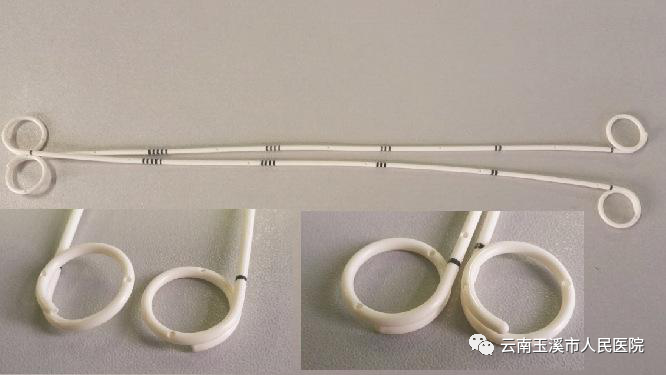 猪尾巴引流管是什么肝胆外科医生带你了解：经皮经肝穿刺置管引流术治疗肝脓肿_https://www.jmylbn.com_新闻资讯_第8张