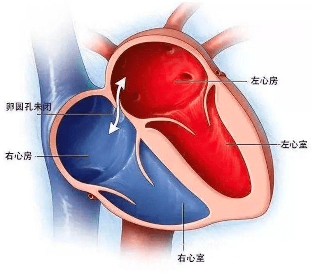 心房心室图四格图片