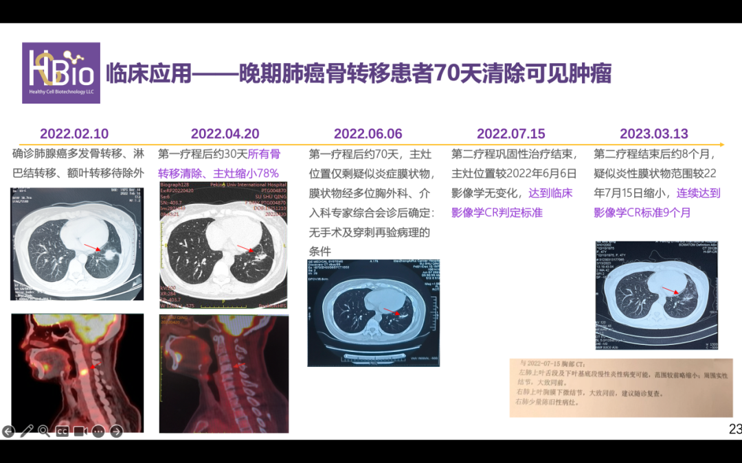 电渗析工程学_电渗析设计_电渗析原理与过程