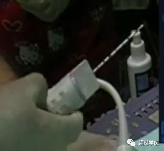 活检针怎么用空芯穿刺活检针的使用_https://www.jmylbn.com_新闻资讯_第5张