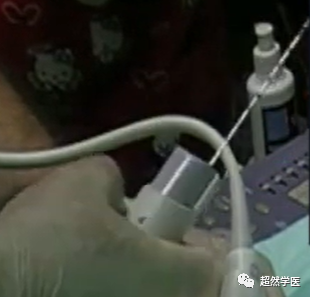 活检针怎么用空芯穿刺活检针的使用_https://www.jmylbn.com_新闻资讯_第4张