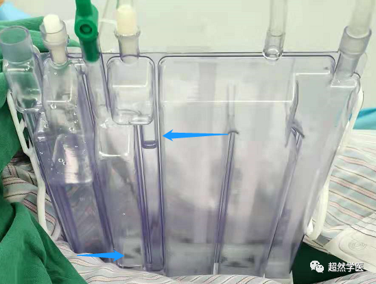 为什么负压引流胸管引流知识点_https://www.jmylbn.com_新闻资讯_第3张