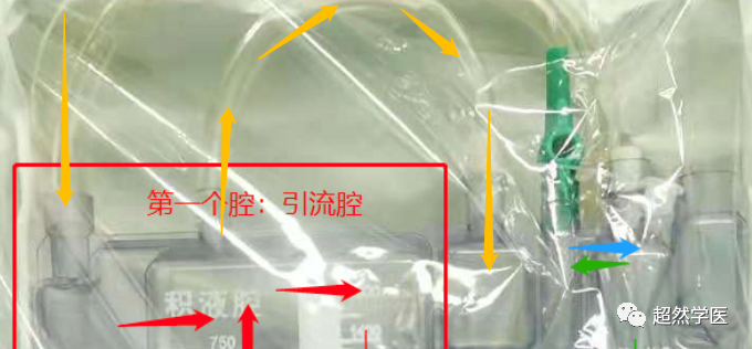 为什么负压引流胸管引流知识点_https://www.jmylbn.com_新闻资讯_第4张